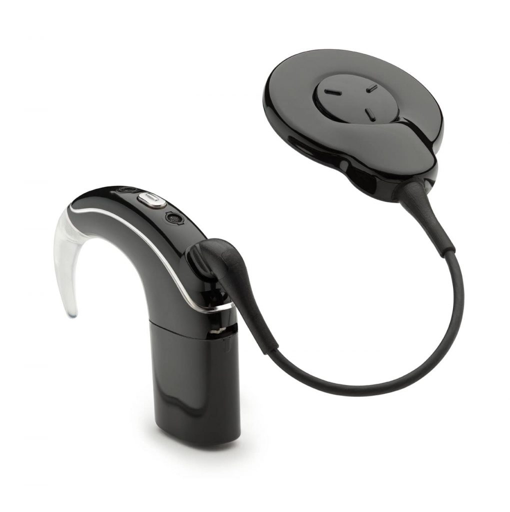 Cochlea Implantat min